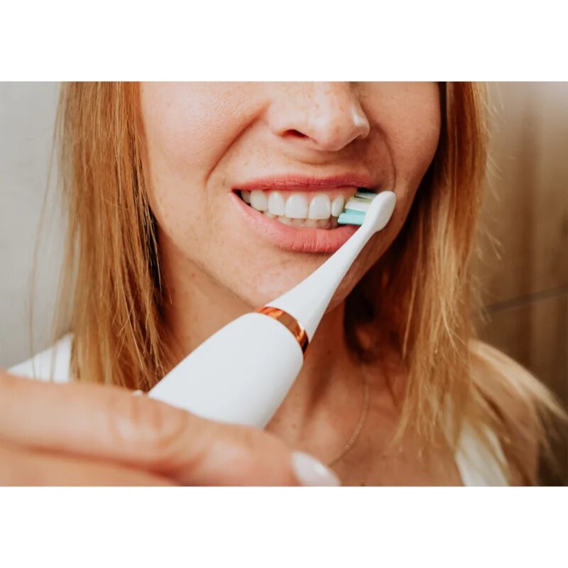 Concept Perfect Smile ZK7010 Sonic elektromos fogkefe tokkal White 1 db