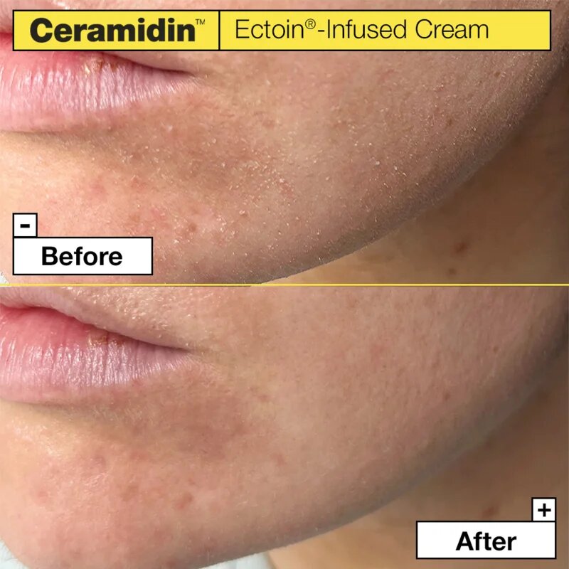 Dr. Jart+ Ceramidin™ Ectoin-Infused Cream hidratáló arckrém ceramidokkal 50 ml