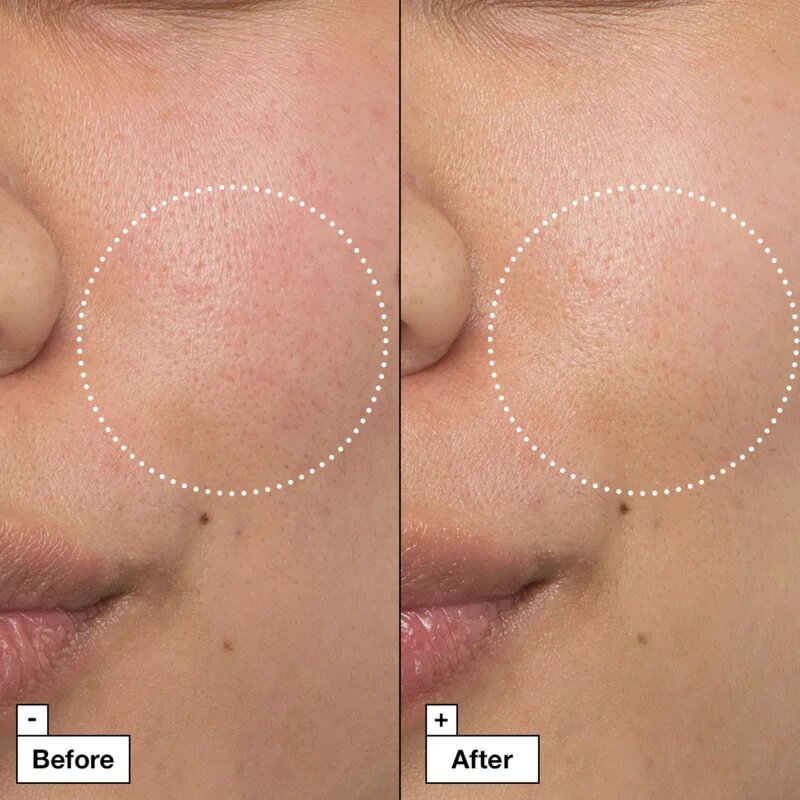 Dr. Jart+ Cicapair™ Intensive Soothing Repair Cream Intenzív ápolás a bőrpír ellen 50 ml
