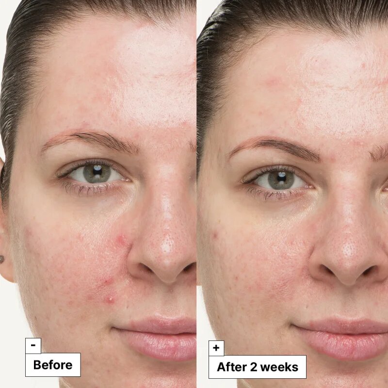 Dr. Jart+ Cicapair™ So Soothing Treatment helyi ápolás semlegesíti a bőrpírt 30 ml