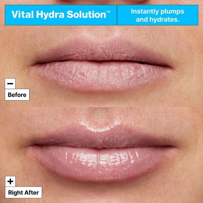 Dr. Jart+ Vital Hydra Solution™ Hydrating Lip Mask Jelly Bear Edition hidratáló maszk az ajkakra 20 ml