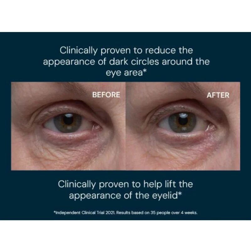 Elemis Pro-Collagen Vitality Eye Cream szemkrém 15 ml