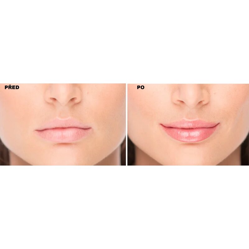 FacEvolution LipPlus Booster ajaknövelő ápolás árnyalat Transparent 5 ml