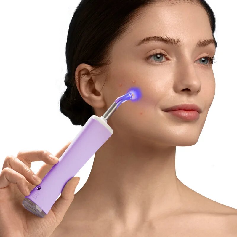 FOREO ESPADA™ 2 Plus toll kék világítással a pattanások csökkentésére Lavender 1 db