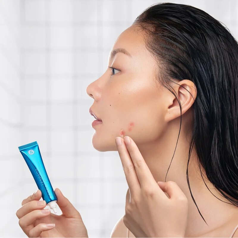 FOREO ESPADA™ BHA+PHA Blemish Solution lokális gél pattanásokra 15 ml