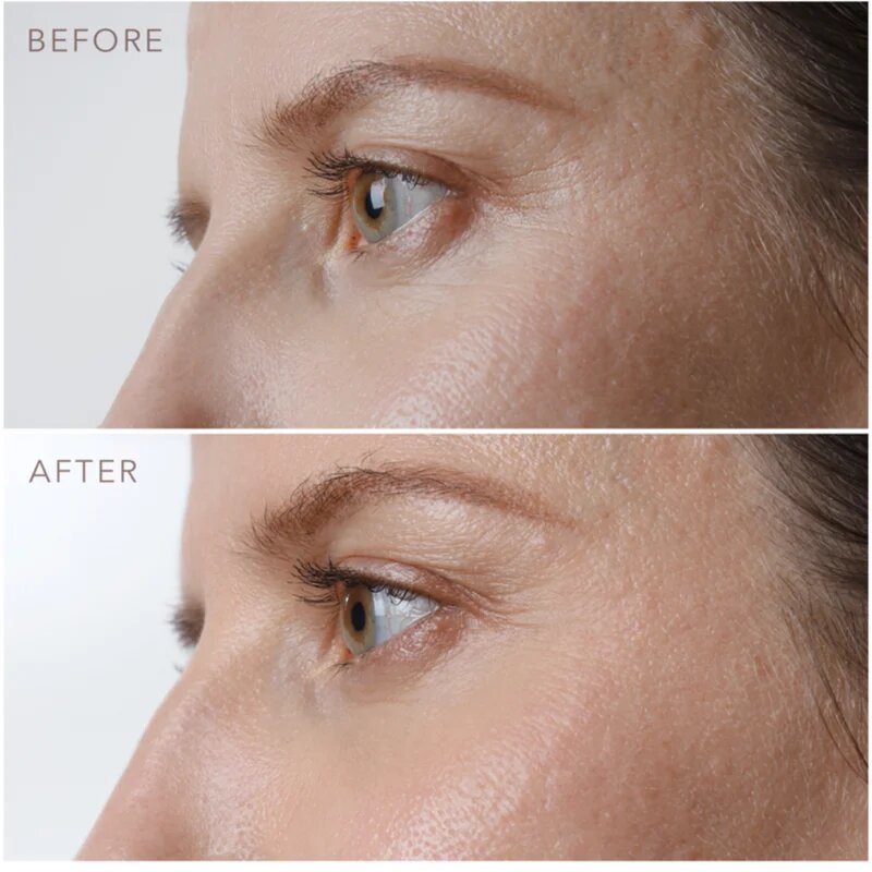 FOREO IRIS™ Firming Eye Serum fiatalító szérum szemkörnyékre 15 ml