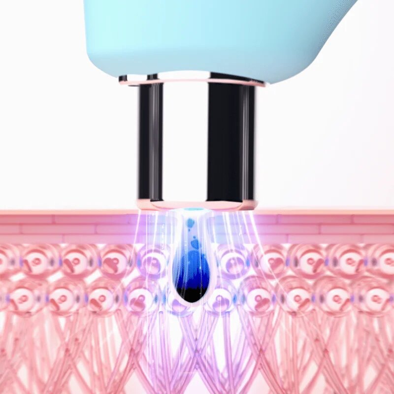 FOREO KIWI™ vákuumos készülék mitesszerek eltávolítására kék LED-fénnyel 1 db