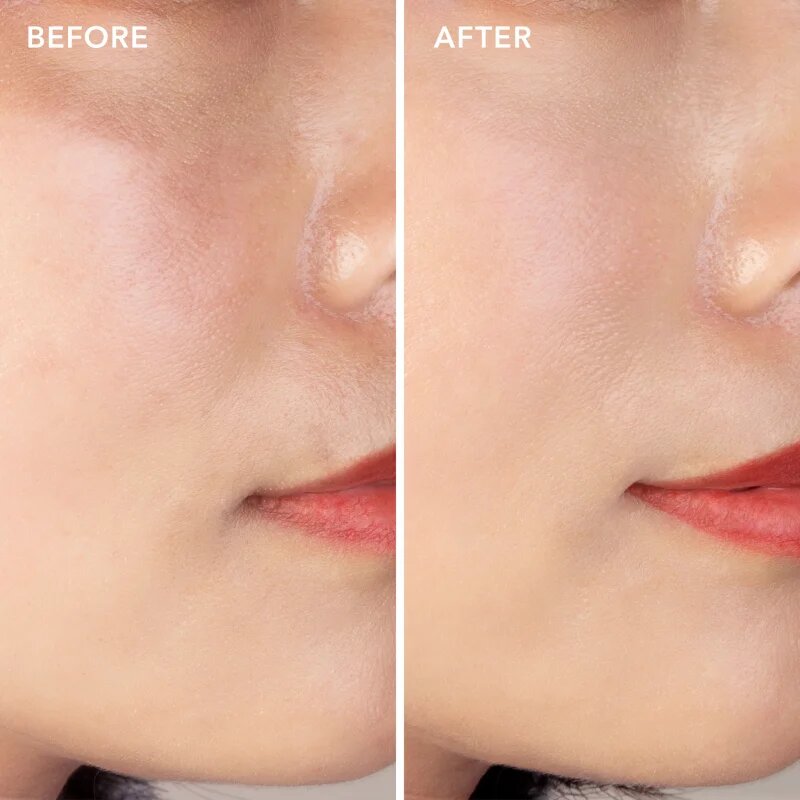 FOREO SUPERCHARGED Barrier Restoring Essence Mist arcpermet esszencia a bőrréteg megújítására 110 ml