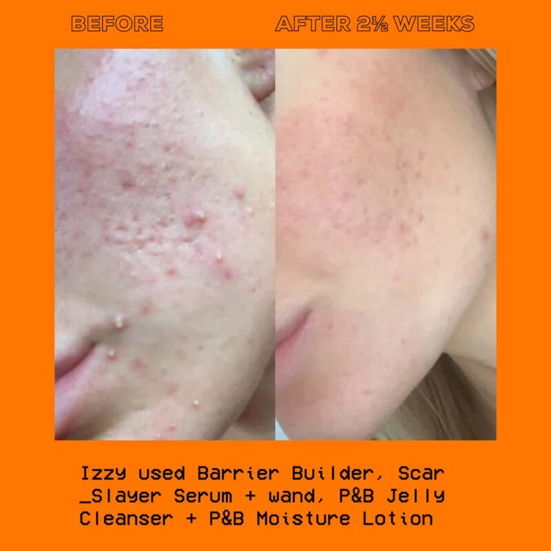 Glow Hub The Scar Slayer élénkítő szérum a pigment foltok ellen 30 ml