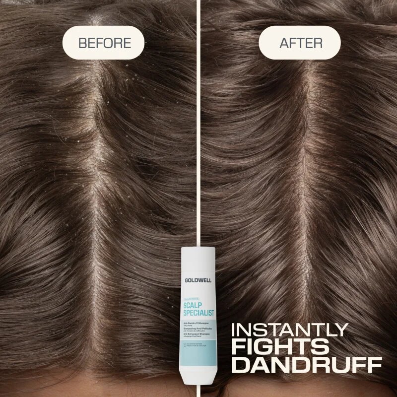 Goldwell Dualsenses Scalp Specialist Anti-Dandruff Shampoo korpásodás elleni sampon 250 ml