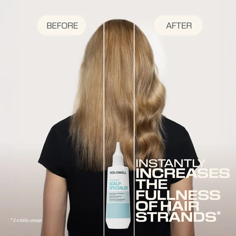 Goldwell Dualsenses Scalp Specialist Anti-Hair Loss Serum szérum hajhullás ellen 150 ml