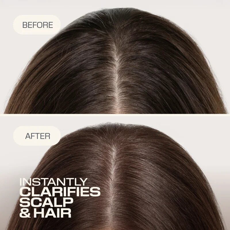 Goldwell Dualsenses Scalp Specialist Clarifying Shampoo mélyen tisztító sampon 250 ml