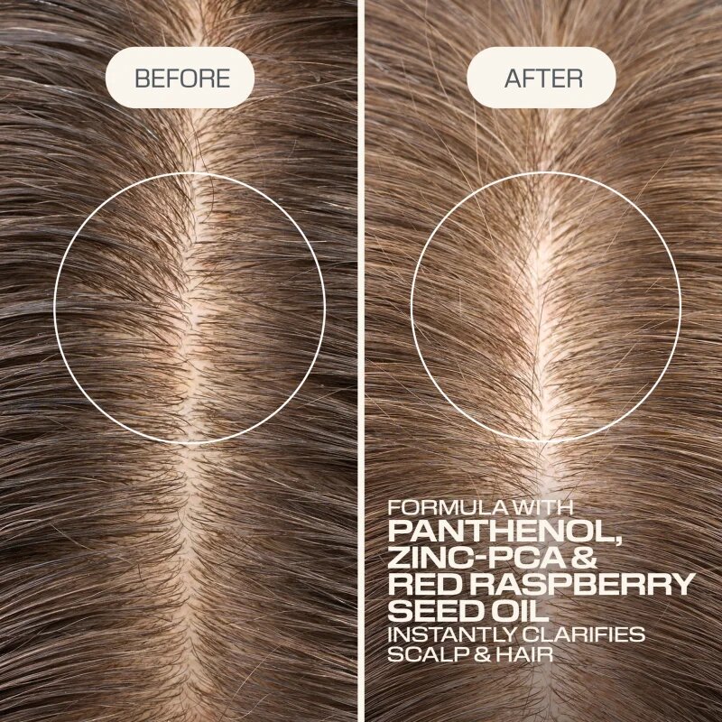 Goldwell Dualsenses Scalp Specialist Clarifying Shampoo mélyen tisztító sampon 250 ml