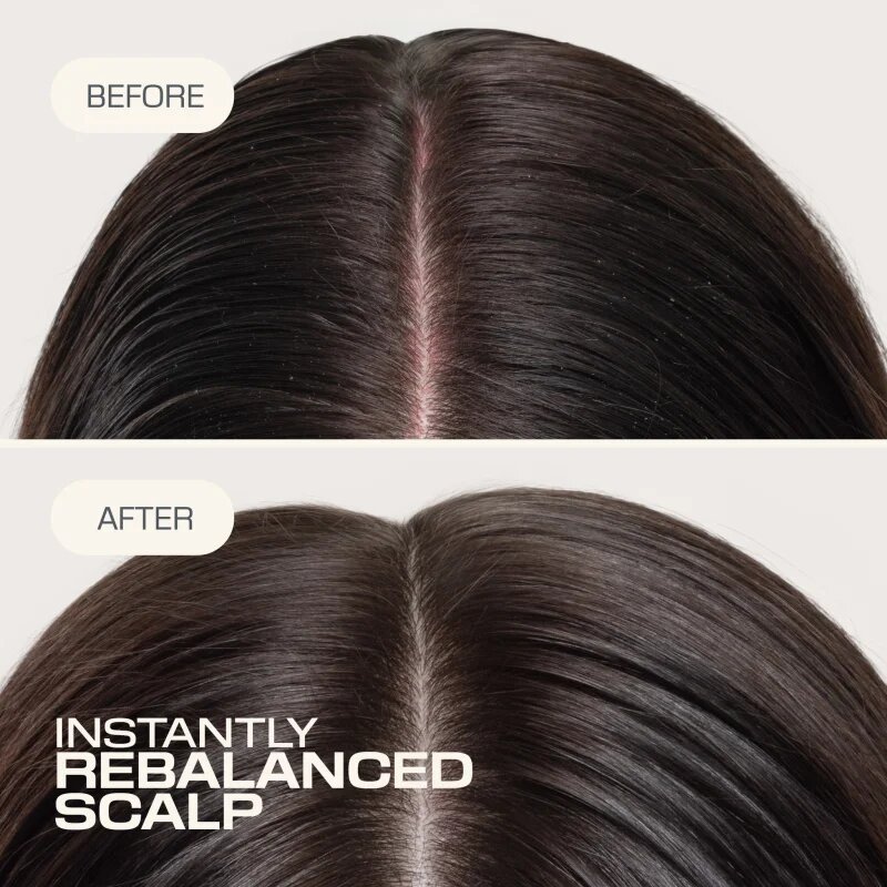 Goldwell Dualsenses Scalp Specialist Rebalance & Hydrate Fluid hidratáló fluid a fej bőrsejtjeinek megújítására 150 ml