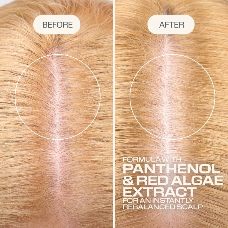 Goldwell Dualsenses Scalp Specialist Rebalance & Hydrate Fluid hidratáló fluid a fej bőrsejtjeinek megújítására 150 ml