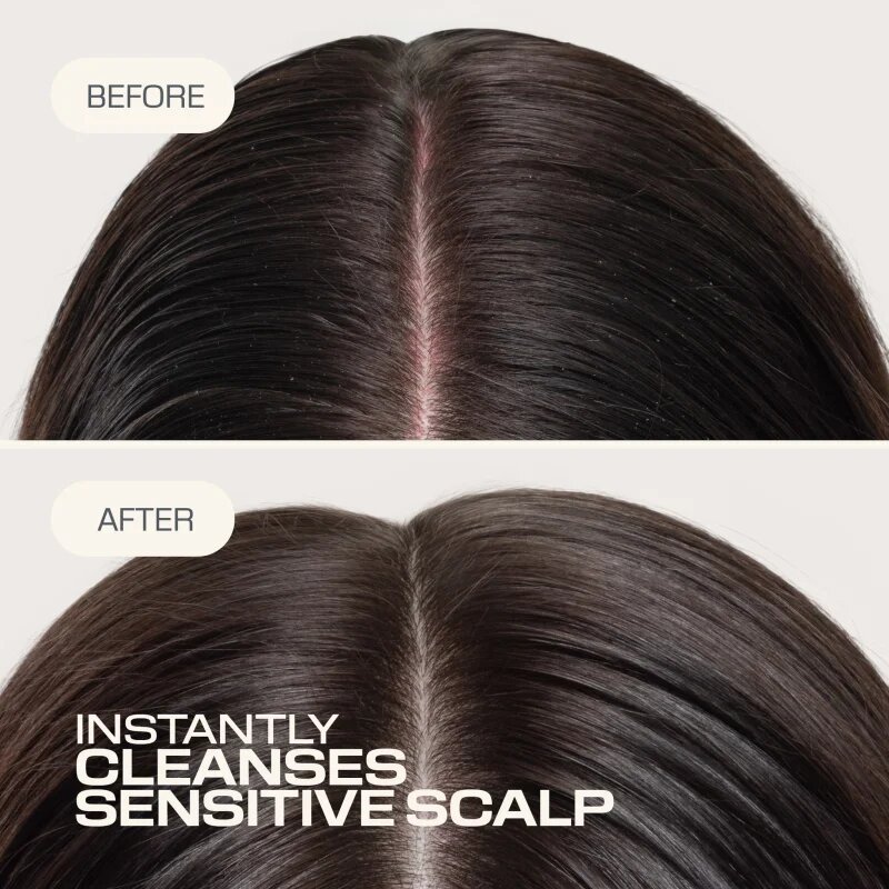 Goldwell Dualsenses Scalp Specialist Sensitive Foam Shampoo habsampon érzékeny fejbőrre 250 ml