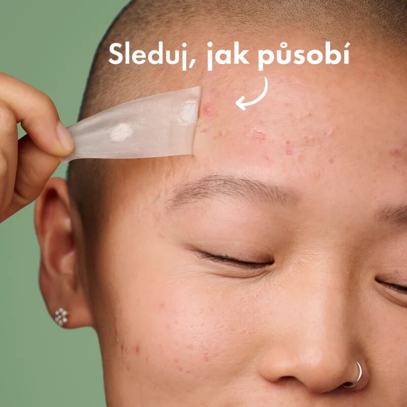 Hero Cosmetics Mighty Patch XL tapasz problémás bőrre 10 db