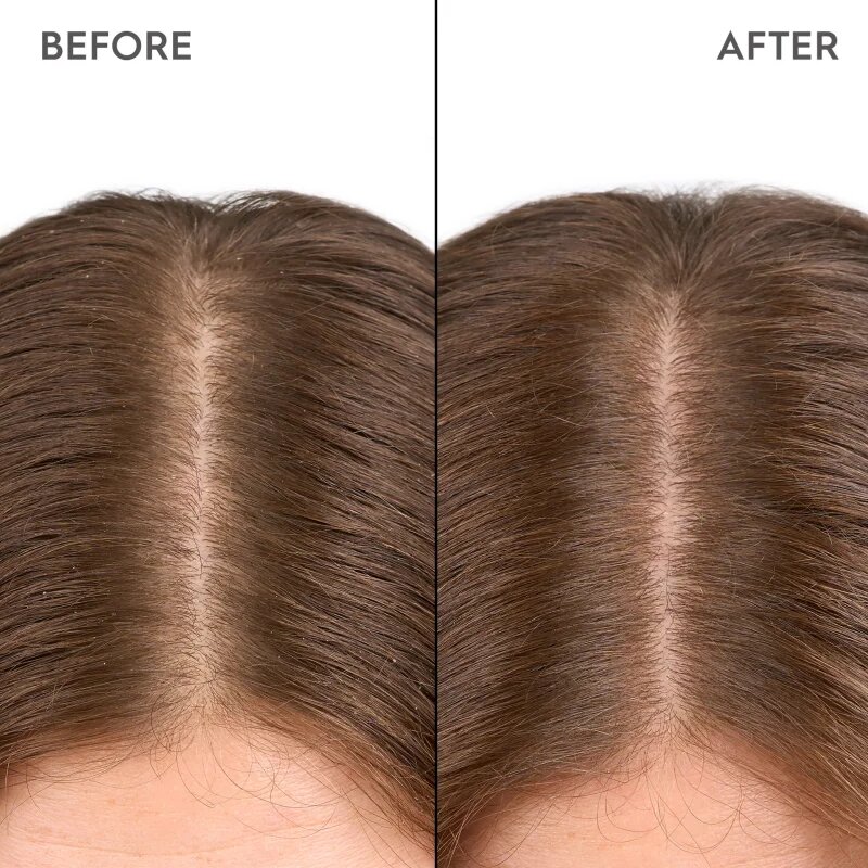 KERASILK Specialists Moisturizing Scalp Drops cseppek a száraz és érzékeny fejbőrre 100 ml