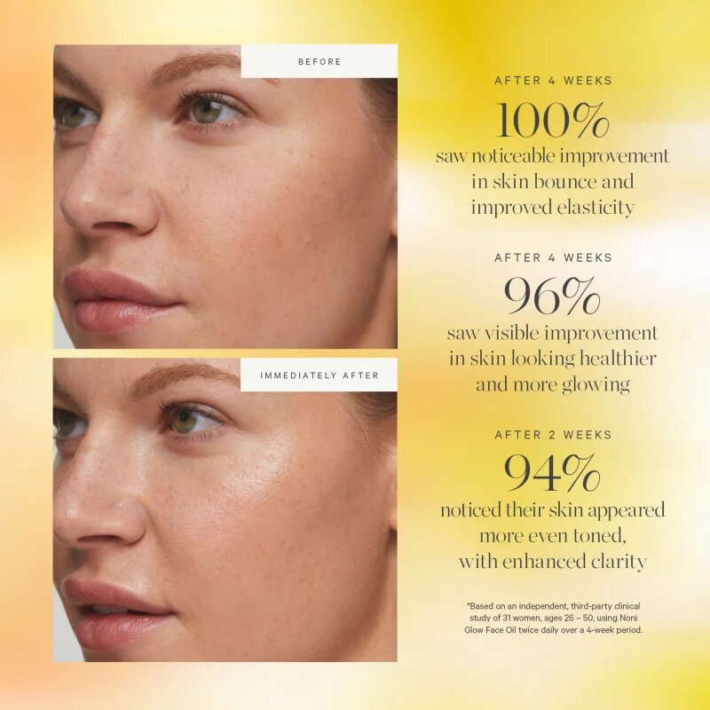 Kora Organics Noni Glow Face Oil arcolaj 10 ml