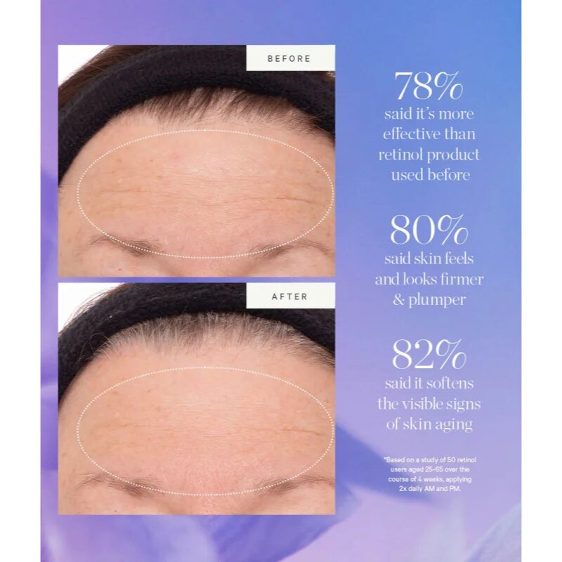 Kora Organics Plant Stem Cell Retinol Alternative Serum bőr szérum retinollal 10 ml
