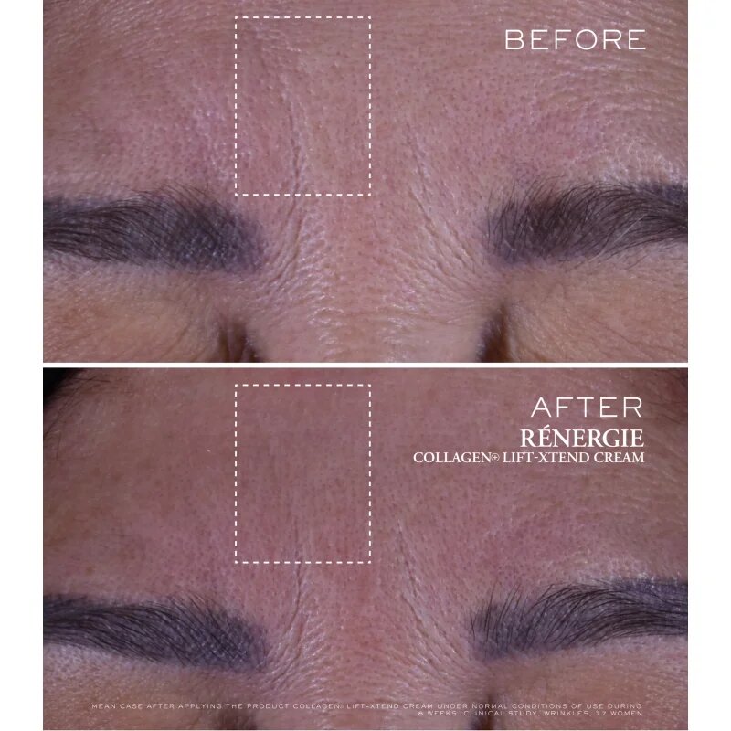 Lancôme Rénergie Collagen+ Lift-Xtend Cream bőrkrém kollagénnel 50 ml