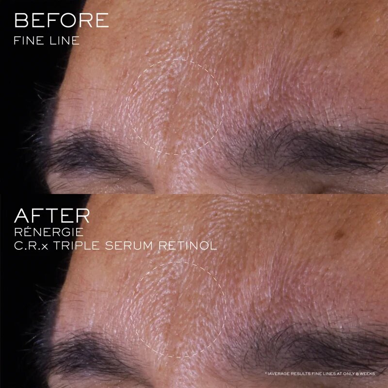 Lancôme Rénergie CRX Triple Serum Retinol bőr szérum 50 ml