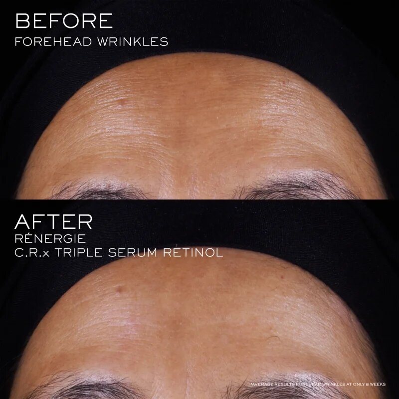 Lancôme Rénergie CRX Triple Serum Retinol bőr szérum 50 ml