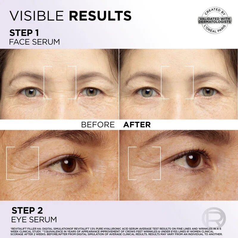 L’Oréal Paris Revitalift Filler arcápoló szett az arcra és a szem környékére
