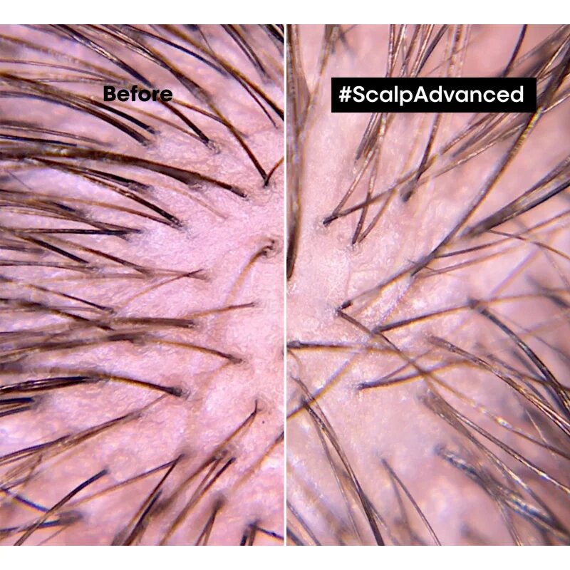 L’Oréal Professionnel Serie Expert Scalp Advanced hajápolás a hajra és a fejbőrre 200 ml