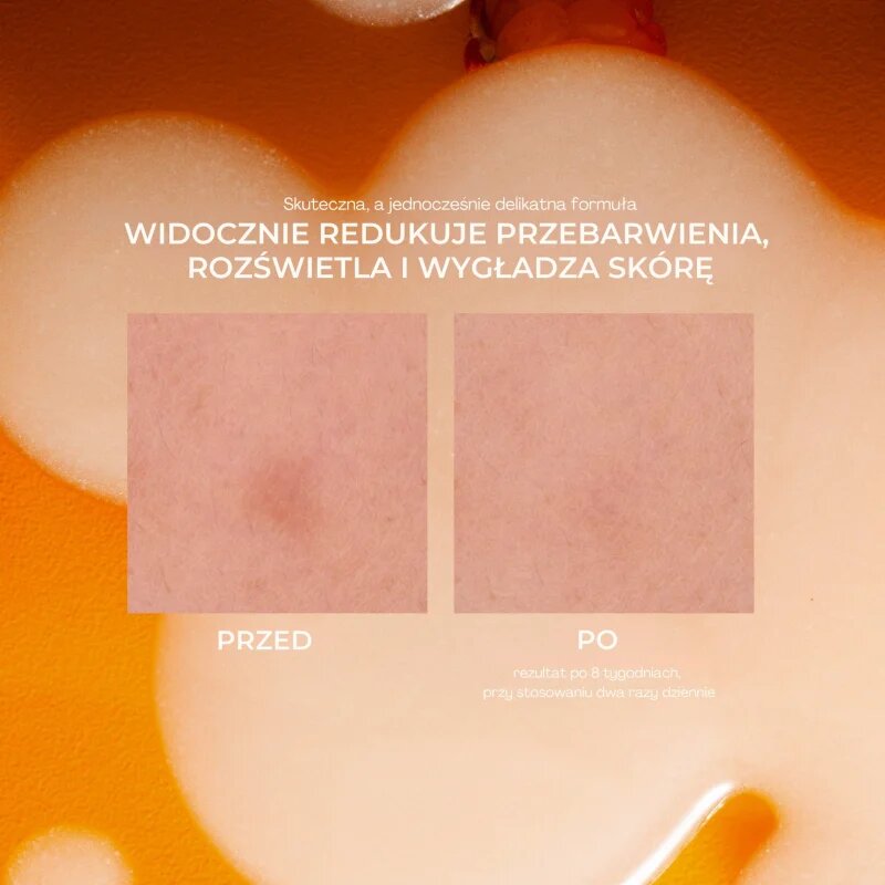 Lumene Nordic-C [VALO] Dark Spot Serum bőrélénkítő szérum C-vitaminnal a pigment foltok ellen 30 ml
