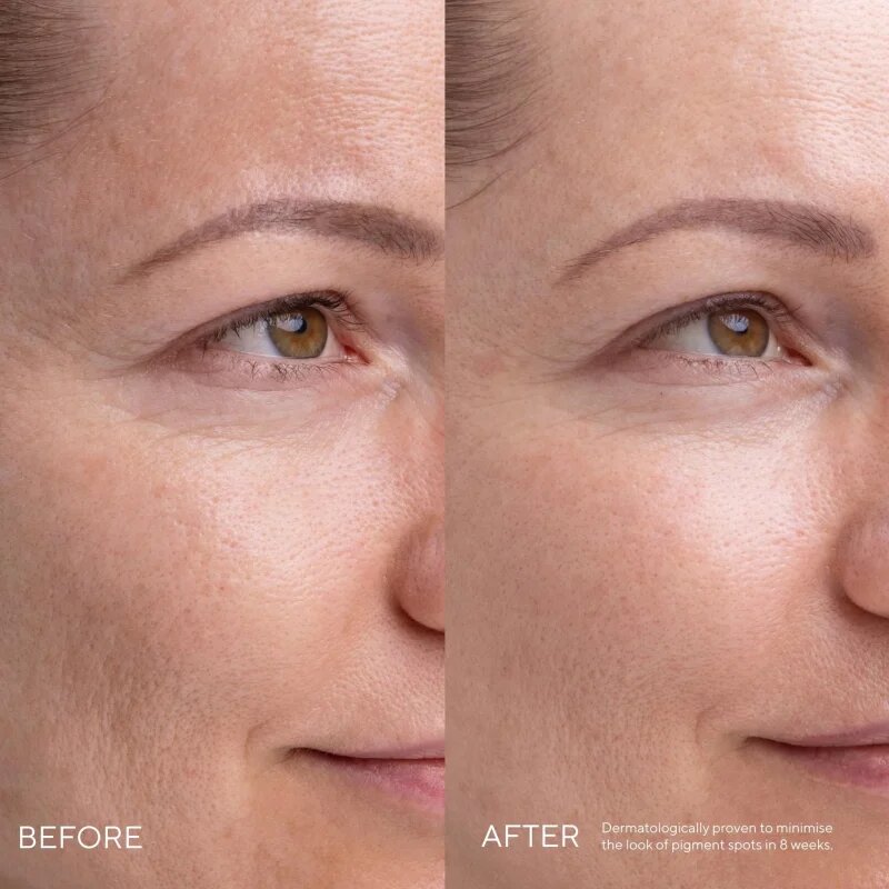 Mádara MÁDARA Kojic Alternative Pigment Serum szérum a pigment foltok ellen 30 ml
