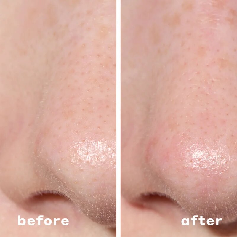 Mario Badescu 2-in-1 Deep Cleansing Pore Strip tapasz problémás bőrre 2 az 1-ben 6 db