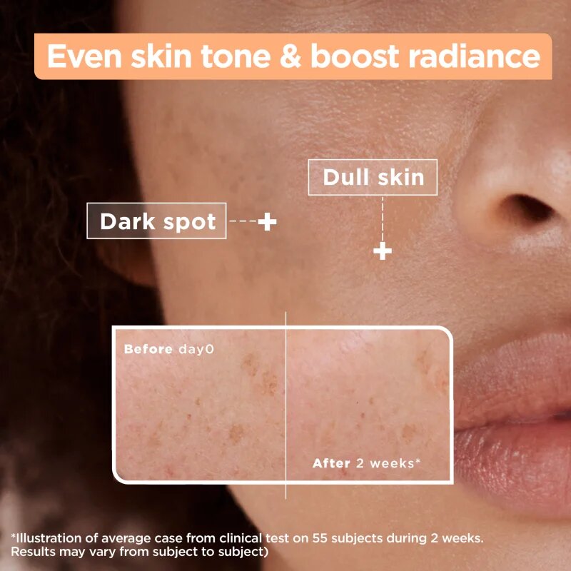 MIXA Anti-Dark Spot szérum a pigment foltok ellen 30 ml