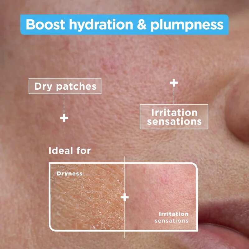 MIXA Anti-Dryness nyugtató és hidratáló szérum 30 ml