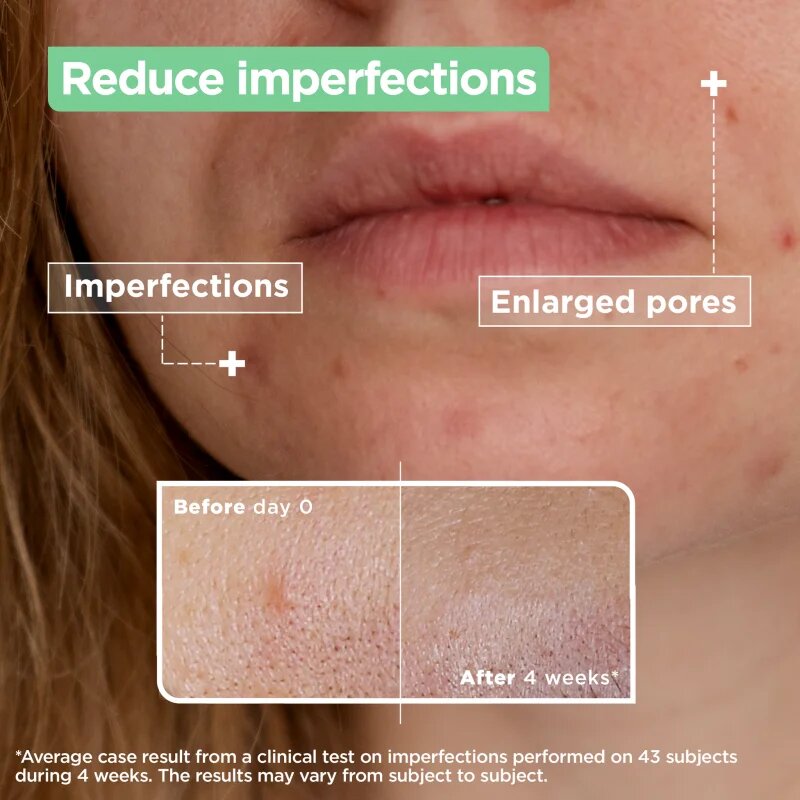 MIXA Anti-Imperfection szérum problémás és pattanásos bőrre 30 ml