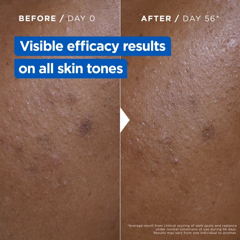 MIXA Niacinamide Bright intenzíven hidratáló krém a sötét foltok ellen 400 ml
