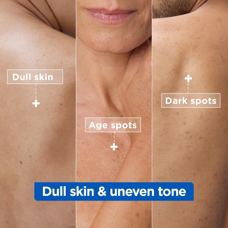MIXA Niacinamide Bright intenzíven hidratáló krém a sötét foltok ellen 400 ml