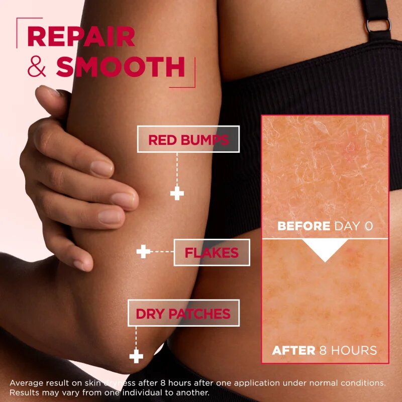 MIXA Urea Cica Repair+ regeneráló testkrém a nagyon száraz bőrre 150 ml