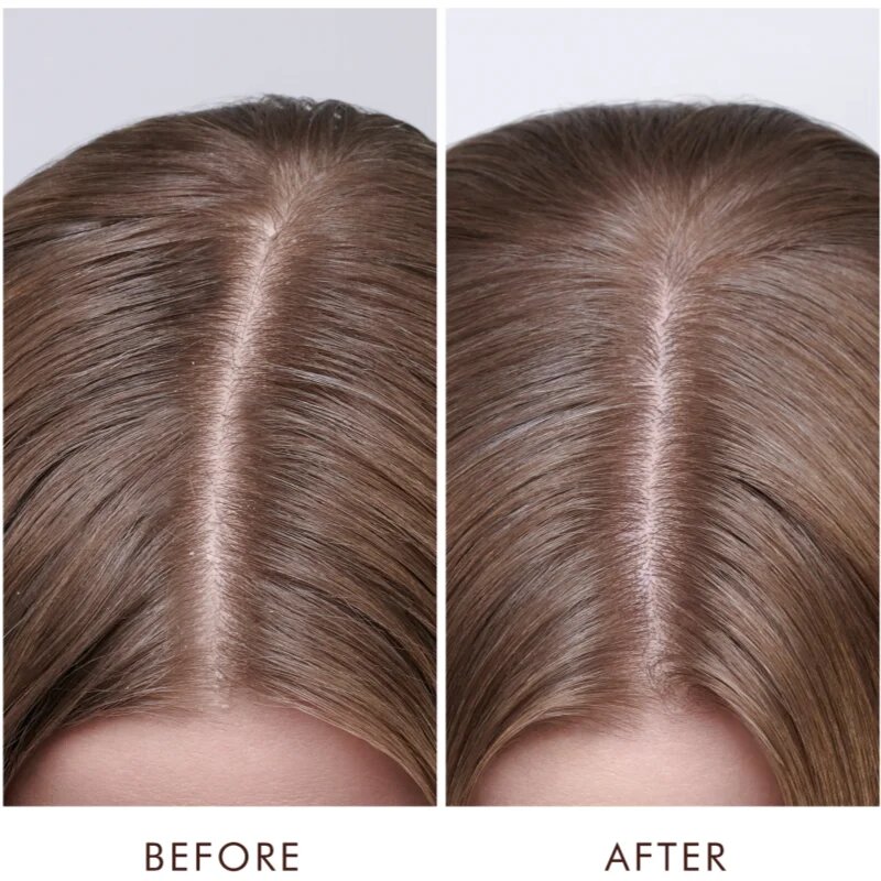 Moroccanoil Scalp Dry Scalp Treatment mélyen tápláló kúra száraz bőrre 45 ml