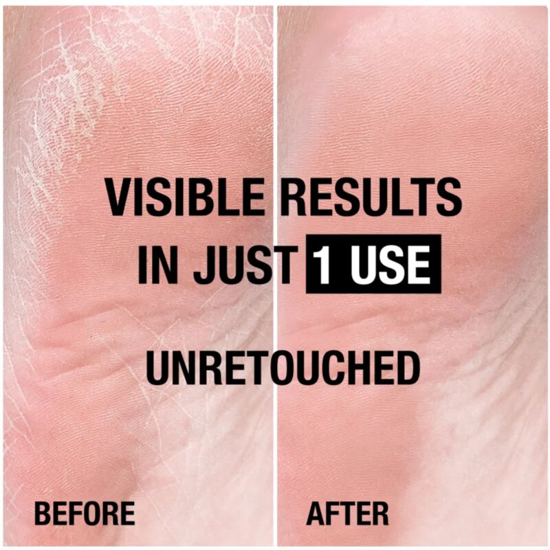 Neutrogena Norwegian Formula® tápláló krém lábfejre 100 ml