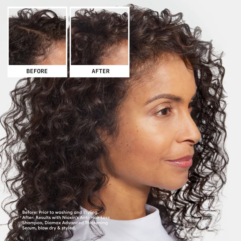 Nioxin Anti-Hair Loss Shampoo sampon hajhullás ellen 240 ml