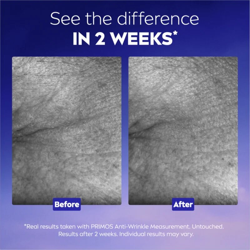 Nivea Cellular Epigenetics ajándékszett a bőr fiatalításáért