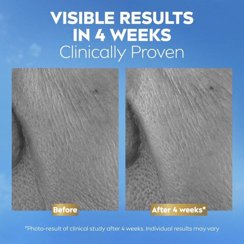 Nivea Q10 Anti-Wrinkle Collagen Expert ránctalanító szérum kollagénnel 30 ml