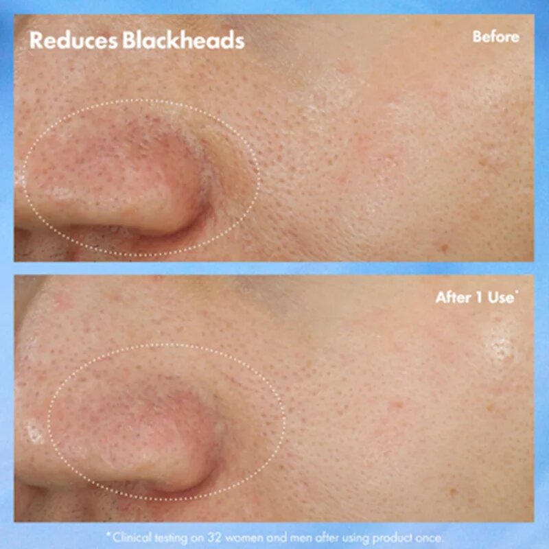 Origins Clear Improvement® Blackhead Clearing Mask-To-Scrub mitesszerek elleni pórustisztító maszk 75 ml