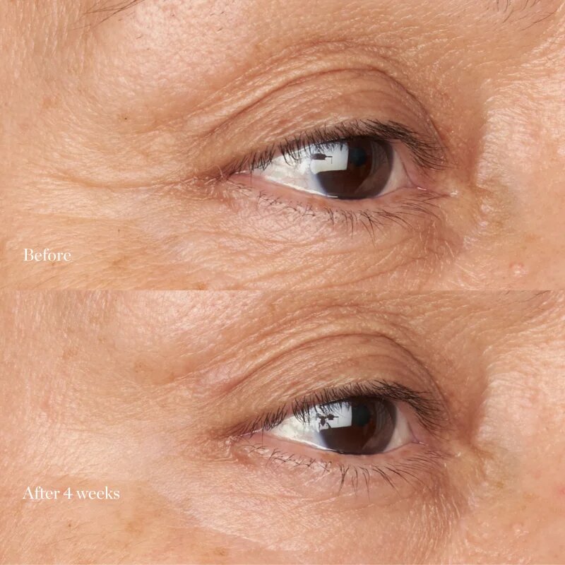 Perricone MD Hypoallergenic Clean Correction Eye Cream hidratáló és élénkítő ápolás a szemhéjakra és a szem körüli részekre 15 ml