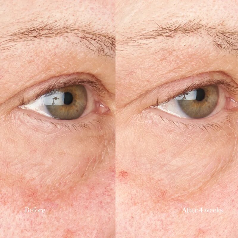Perricone MD Hypoallergenic Clean Correction Eye Cream hidratáló és élénkítő ápolás a szemhéjakra és a szem körüli részekre 15 ml
