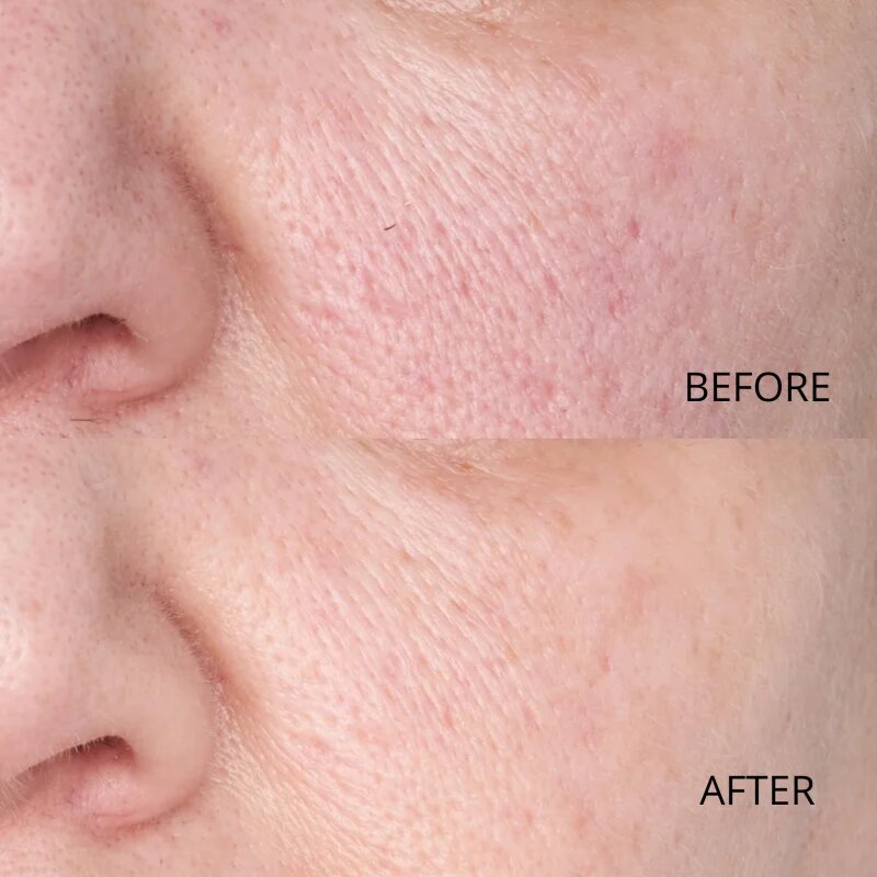 Perricone MD Hypoallergenic Clean Correction Smoothing Restorative Serum tápláló és hidratáló szérum az arcbőr élénkítésére 59 ml