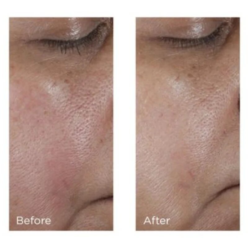 Perricone MD No:Rinse Pore Minimizing Toner intenzív tonik a bőr kisimításáért és a pórusok minimalizásáért 118 ml