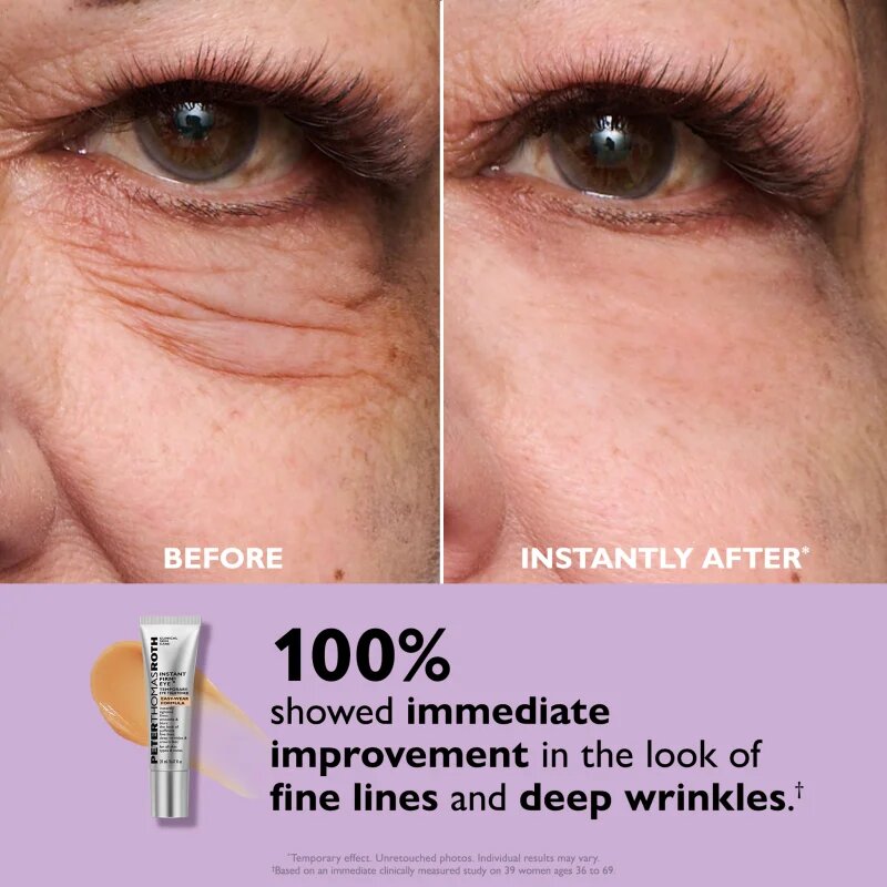 Peter Thomas Roth Instant FIRMx Eye szemkrém a bőr fiatalításáért 20 ml