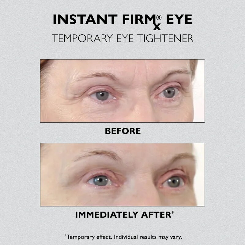 Peter Thomas Roth Instant FIRMx Eye szemkrém a bőr fiatalításáért 30 ml